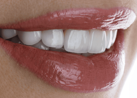 İmplantlar ve Sanatçılar: Sahnedeki Gülüşün Hikayesi