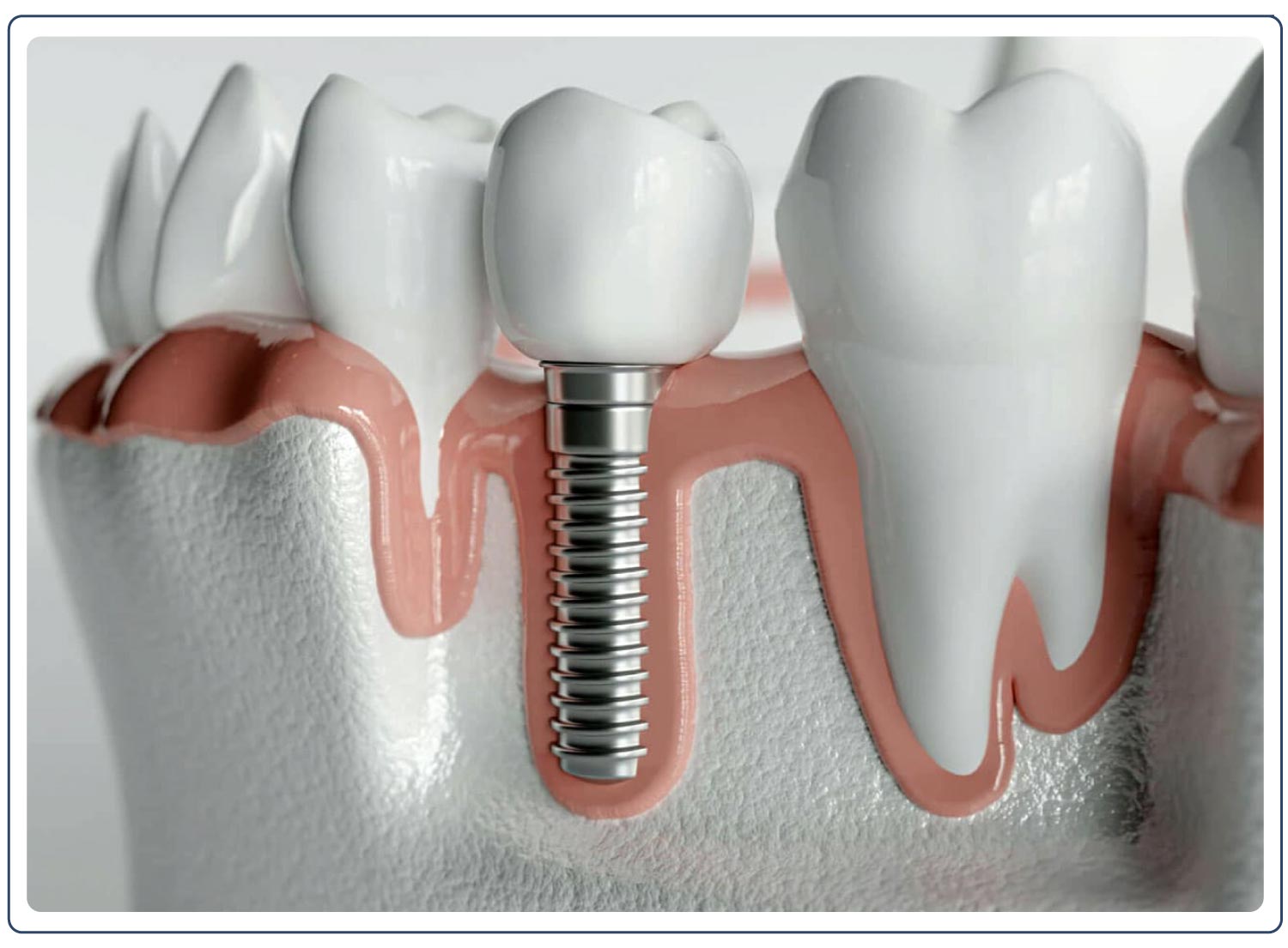 Şehir Hayatı, Stres ve Diş Kayıpları